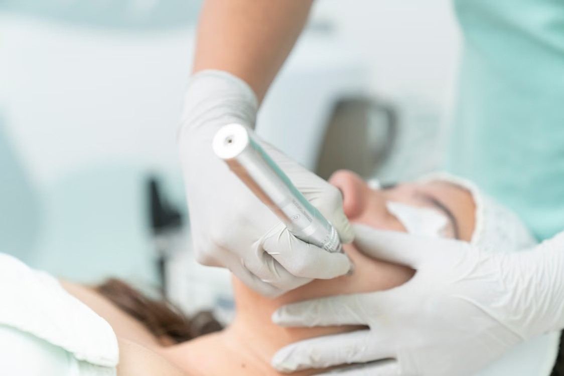 ممارس يرتدي قفازات طبية أثناء إجراء علاج تجميلي